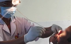 Gắp con đỉa dài 10cm còn sống ra khỏi mũi bệnh nhân