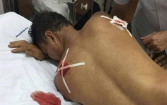 Hải Phòng: Đâm trọng thương hàng xóm vẫn được tại ngoại