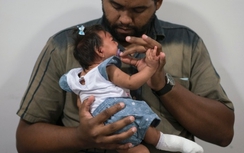 Xác nhận phát hiện virus Zika trong nước bọt và nước tiểu