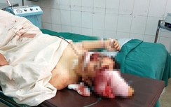 Chồng chém vợ rồi cắt cổ tự tử bất thành ở Đắk Nông