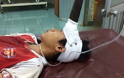 Cứu sống bé trai bị dao găm sâu giữa trán