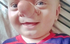 Sốc với cậu bé Pinocchio ngoài đời thực