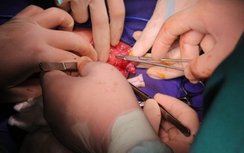 Quảng Ninh: Cấp cứu thành công trẻ sơ sinh bị thoát vị rốn