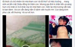 Thực hư bé gái 4 tuổi bầm xước khắp cơ thể khi đến trường?