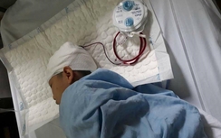 Thầy giáo tát học sinh gây tụ máu não?