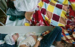 Đổ xăng đốt con và cháu vì bực chuyện nhuộm tóc đỏ