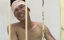 Thanh niên ngáo đá, khỏa thân xông vào trụ sở công an