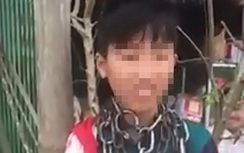 Phá khoá, tháo xích cho bé trai bị xích cổ ở Thanh Hoá