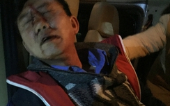 Cần xử nghiêm kẻ đi xe biển giả, hành hung tài xế xe khách