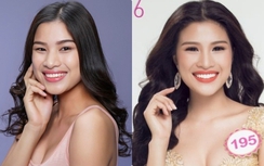 BTC Hoa hậu Việt Nam chỉ loại 1 thí sinh làm răng sứ