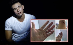 Đông Hùng bị chủ nợ chém: Nhạc sĩ Quốc Trung kêu gọi giúp đỡ