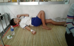 Nhiều học sinh nhập viện sau khi súc miệng bằng dung dịch Fluor