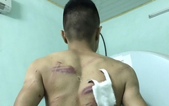 Bắt 7 nghi phạm truy sát ba người đàn ông giữa ban ngày