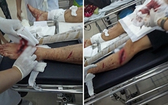 Nhóm côn đồ ngang nhiên truy sát người giữa cửa hàng mỹ phẩm