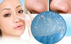 Cách trị mụn đầu đen ở mũi đơn giản mà hiệu quả