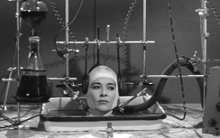 Năm 2017, Trung Quốc có thể cấy ghép đầu người?