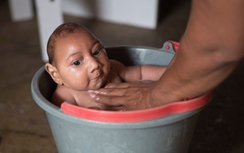 Phát hiện ca nhiễm virus Zika đầu tiên tại Lào, Việt Nam lo lắng