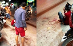 Video: Truy sát kinh hoàng, bị chém đứt lìa bàn tay