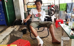 Va chạm với ô tô, người đi xe máy bị đánh gãy tay chân