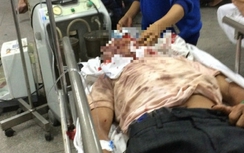 Đánh người tới chấn thương sọ não vì cái... đầu trâu