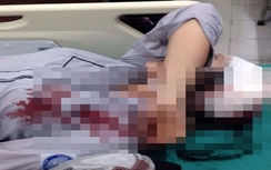 Công an Hà Nội triệu tập hai nghi can đánh nữ sinh nhập viện