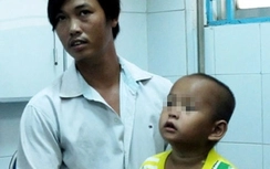 Gắp thành công dị vật khiến bé 4 tuổi ho ra tiếng kèn