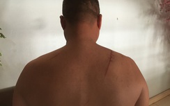 GĐ bị chém, doạ giết cả nhà, thủ phạm bảo "đi tù cũng được"