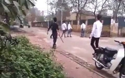 "Côn đồ làng" đánh nam sinh lớp 9 chấn thương sọ não