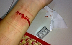 Bất bình cô giáo, học viên cắt động mạch tự tử