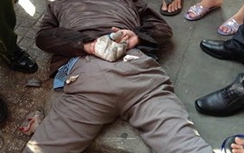 Cướp tiệm vàng bất thành, phải vào viện cấp cứu