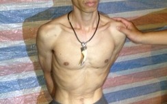 Mua ma tuý chưa kịp sử dụng đụng 141