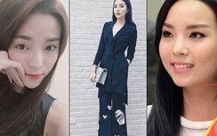 Hoa hậu Kỳ Duyên cứng đơ như tượng vì sửa cằm?