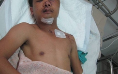 Cứu sống, tạo hình lại khuôn mặt dập nát cho nạn nhân TNGT