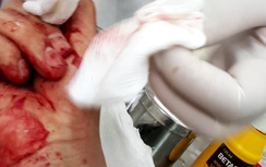 Nhà báo Đỗ Doãn Hoàng bị hành hung: Hội Nhà báo VN vào cuộc