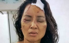 Cô giáo bị chồng cũ bạo hành tàn độc như thời trung cổ