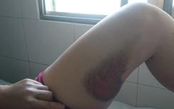 Long An: Xô xát với công an xã, 3 phụ nữ nhập viện