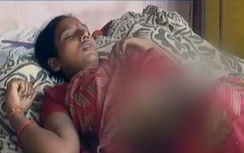 Bị mẹ chồng đổ axit lên bụng vì nghi sinh con gái