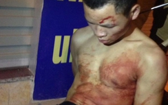 Clip bắt sống thanh niên cứa cổ tài xế taxi ở Hà Nội