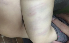 Sa thải cô giáo dùng đũa đánh học sinh tại Thanh Hóa