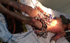 Vụ dùng xăng đốt quán bi-a: Gia đình nạn nhân nói gì?