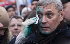 Lãnh đạo đảng đối lập Nga bị tấn công hóa chất