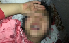 Vụ xâm hại bé gái 9 tuổi: Cần thêm 2 tháng điều tra?