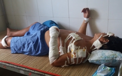 Nghi có bồ, chồng trẻ bị vợ già chém gần 20 nhát