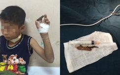 Bé trai 9 tuổi bị nhánh cây đâm xuyên cổ được cứu sống