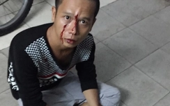 Tên cướp táo tợn ở TP.HCM bị bắt nhờ ... kẹt xe