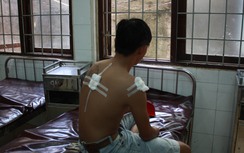 Thông tin mới vụ công an bắn súng cao su, ba người bị thương