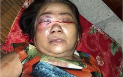 Mâu thuẫn khi chơi bài, nam thanh niên đánh hỏng mắt người "cùng xới"