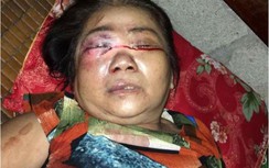 Bắt thanh niên đánh hỏng mắt người phụ nữ cùng “chiếu bạc”