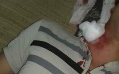 Nghi vấn nam thanh niên bị đạn lạc găm trúng cổ ở Hòa Bình