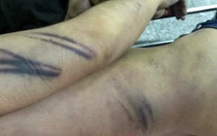 Bắt giam 2 công an đánh chết bị can trong nhà giam